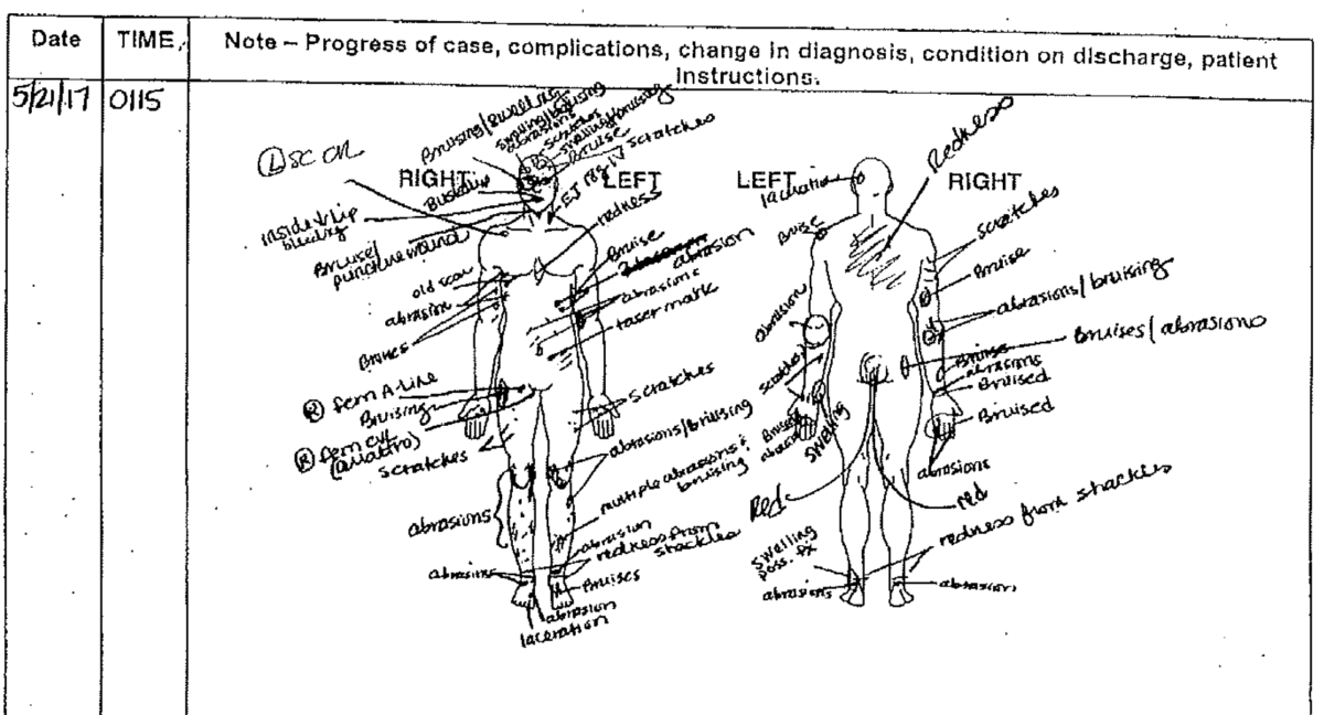 An autopsy chart shows bruising and injury